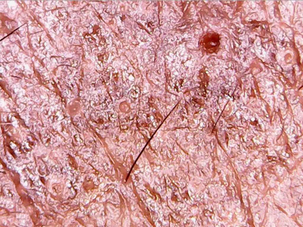 коллаген кожи под микроскопом